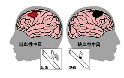 &#20048;&#40060;